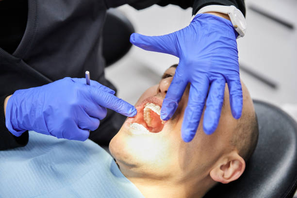 Best Broken or Chipped Tooth Repair in Durand, MI